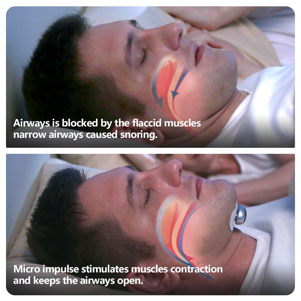 Diagram showing how a micro impulse device helps keep airways open during sleep.